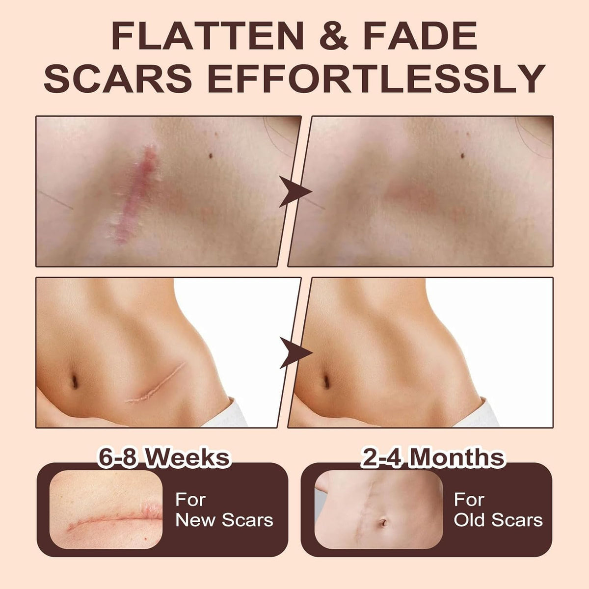 Advanced Medical Grade Silicone Scar Stick