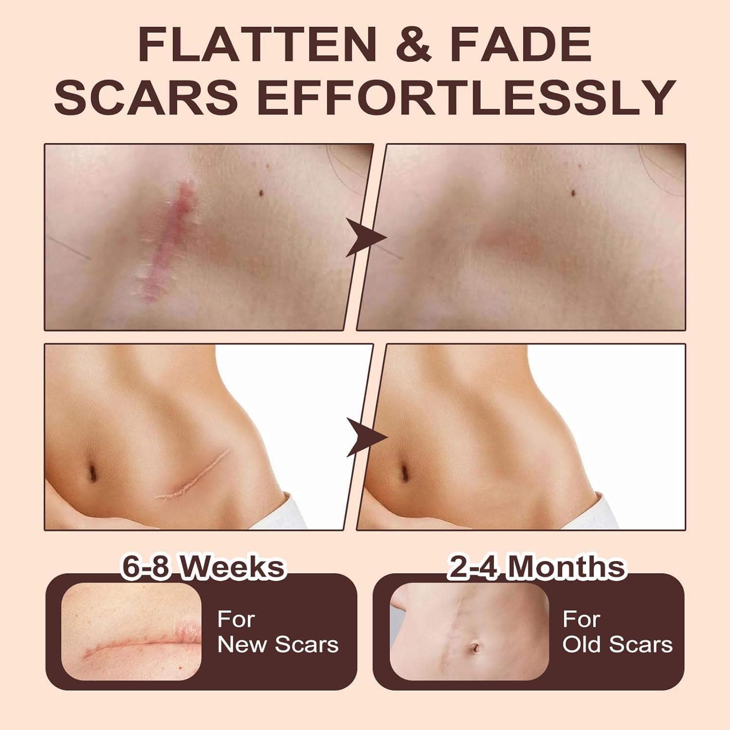 Advanced Medical Grade Silicone Scar Stick