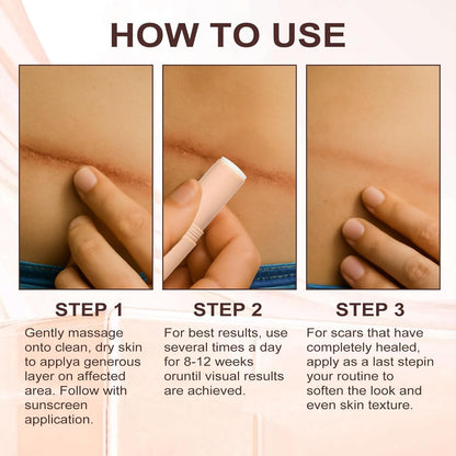 Advanced Medical Grade Silicone Scar Stick